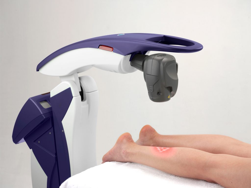 Laser therapy for hotsell plantar fasciitis near me