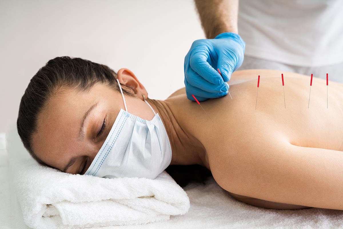 Dry needling