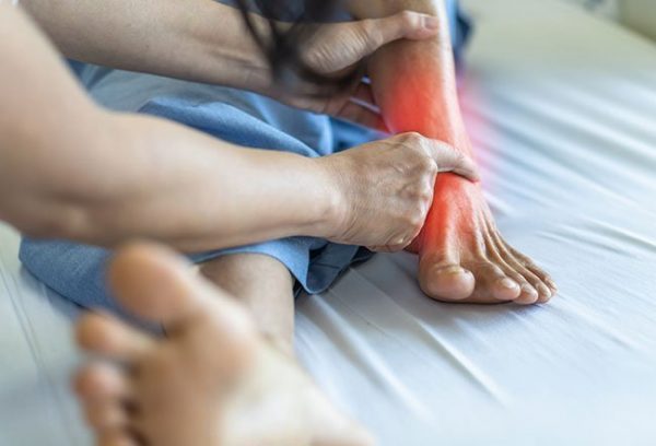 Metatarsal Stress Fractures
