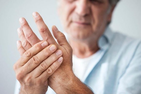 Connective tissue disease