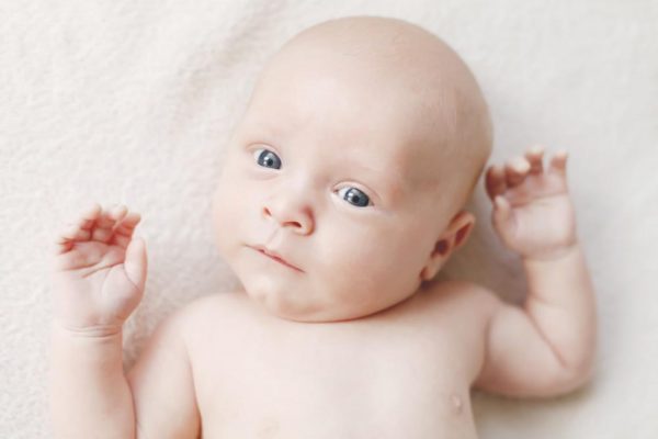 Torticollis