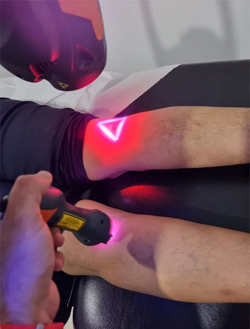 Lymphoedema Physiotherapy